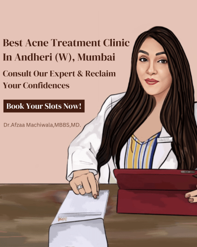 Acne Treatment Andheri