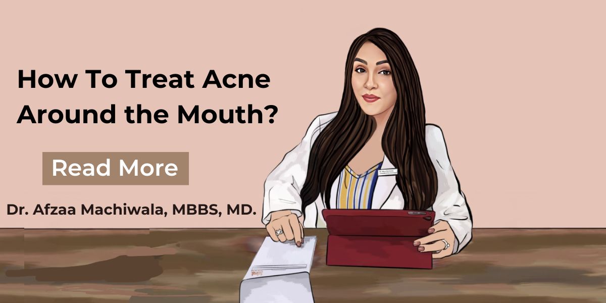 Acne Around The Mouth