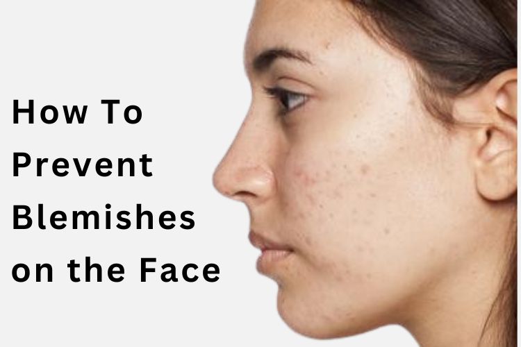 Blemishes on the Face