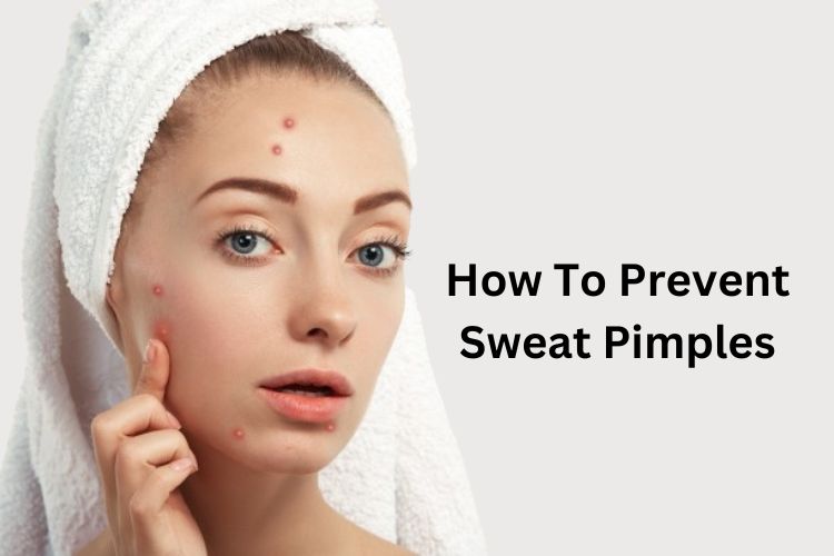 Sweat Pimples