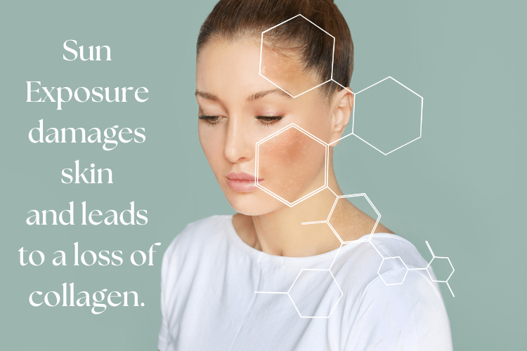 Sun Exposure damages skin and leads to a loss of collagen